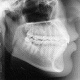 Radiologia Odontológica em Belém